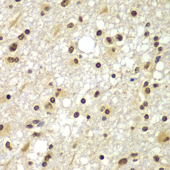 ZNF20 Rabbit polyclonal antibody