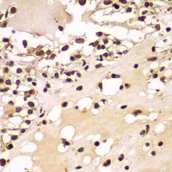ZNF20 Rabbit polyclonal antibody