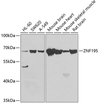 ZNF195 Rabbit polyclonal antibody