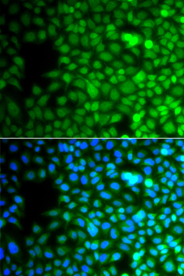 ZNF195 Rabbit polyclonal antibody
