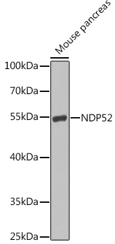 NDP52 Rabbit polyclonal antibody