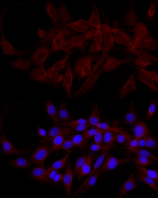 NDP52 Rabbit polyclonal antibody