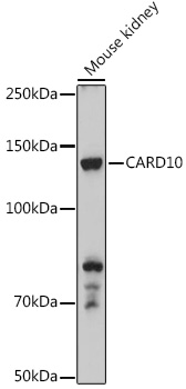 CARD10 Rabbit polyclonal antibody