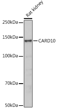 CARD10 Rabbit polyclonal antibody
