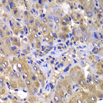CARD10 Rabbit polyclonal antibody