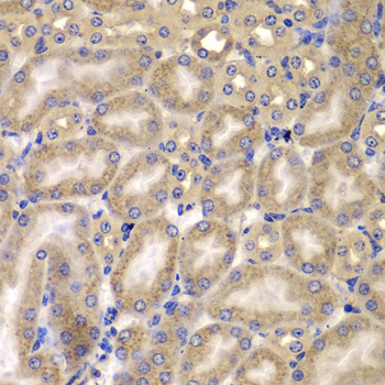 CARD10 Rabbit polyclonal antibody