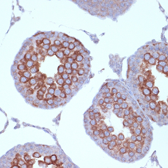 KIF3A Rabbit monoclonal antibody