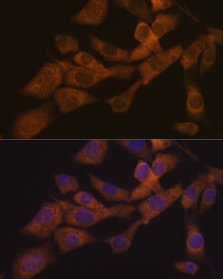 KIF3A Rabbit monoclonal antibody