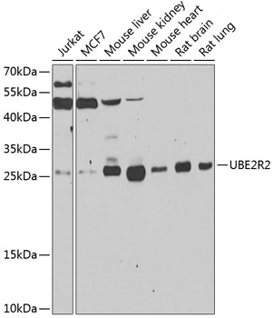 UBE2R2 Rabbit polyclonal antibody
