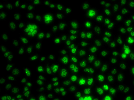 UBE2R2 Rabbit polyclonal antibody