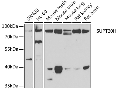 SUPT20H Rabbit polyclonal antibody