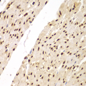 SUPT20H Rabbit polyclonal antibody