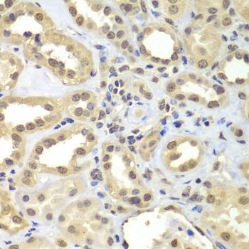SUPT20H Rabbit polyclonal antibody