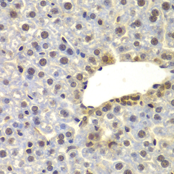 SUPT20H Rabbit polyclonal antibody