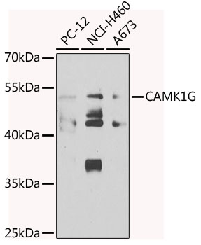 CAMK1G Rabbit polyclonal antibody