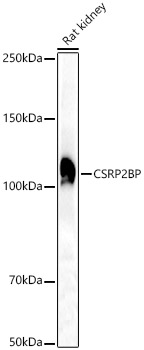 CSRP2BP Rabbit polyclonal antibody