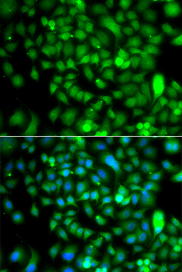 CSRP2BP Rabbit polyclonal antibody