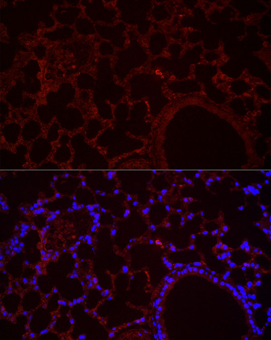 NLRC4 Rabbit polyclonal antibody