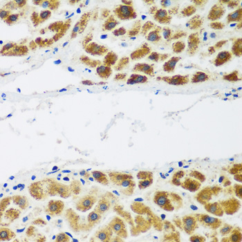 NAA60 Rabbit polyclonal antibody