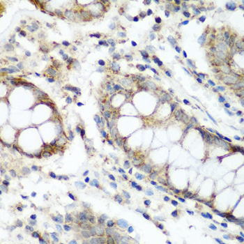 NAA60 Rabbit polyclonal antibody