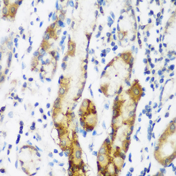 NAA60 Rabbit polyclonal antibody