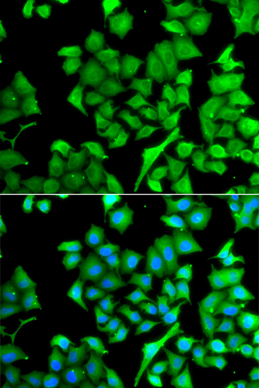 NAA50 Rabbit polyclonal antibody