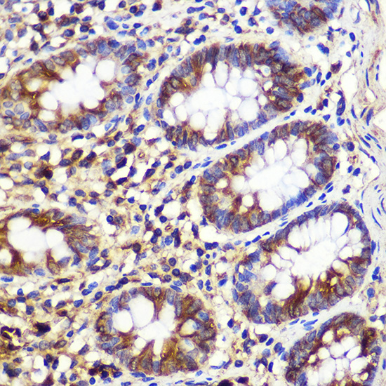 ATG10 Rabbit polyclonal antibody