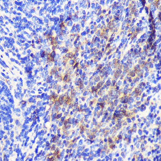 ATG10 Rabbit polyclonal antibody