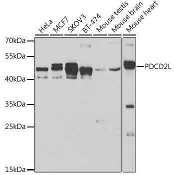 PDCD2L Rabbit polyclonal antibody