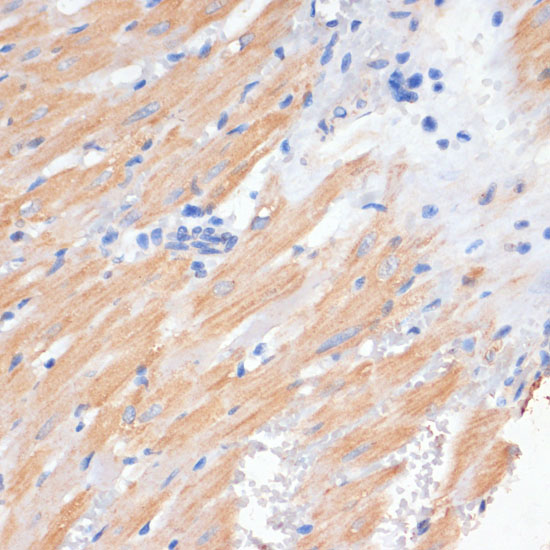 PDCD2L Rabbit polyclonal antibody