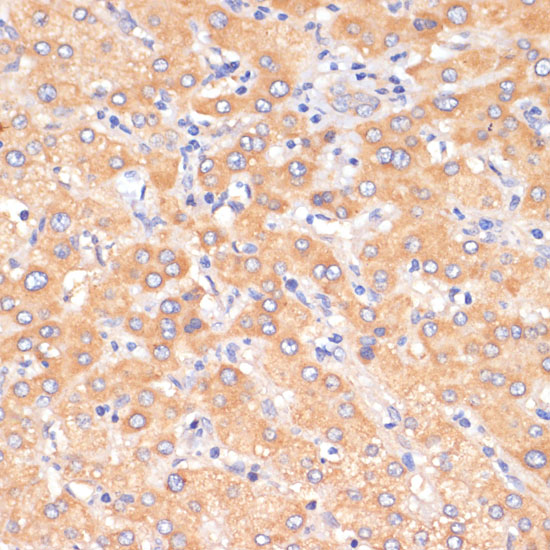 PDCD2L Rabbit polyclonal antibody