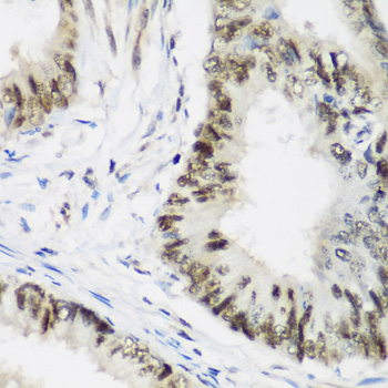 AEBP2 Rabbit polyclonal antibody