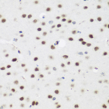 AEBP2 Rabbit polyclonal antibody