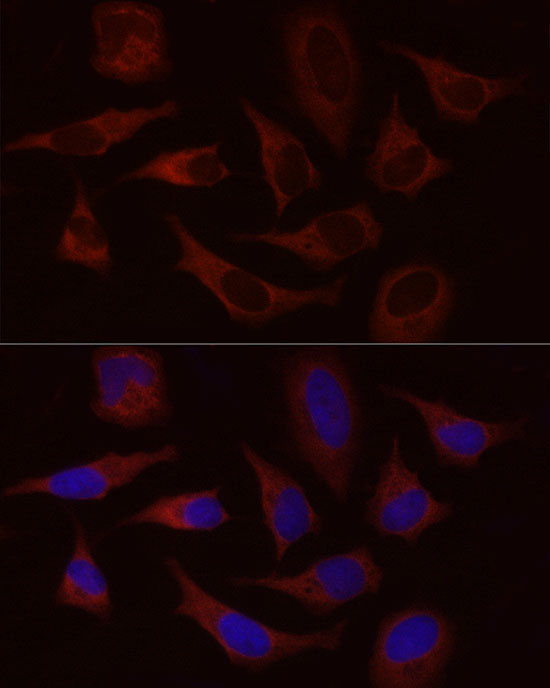 STIM1 Rabbit polyclonal antibody