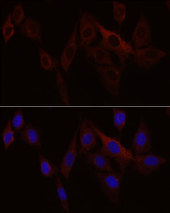 STIM1 Rabbit polyclonal antibody