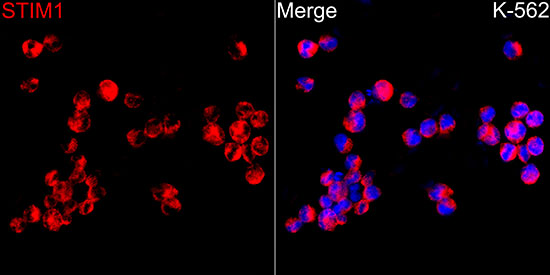STIM1 Rabbit polyclonal antibody