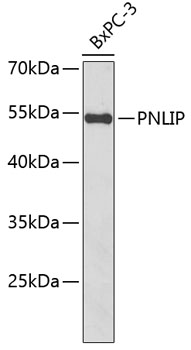 PNLIP Rabbit polyclonal antibody