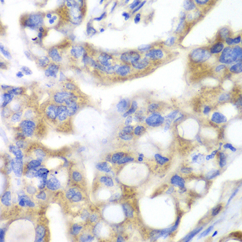 PNLIP Rabbit polyclonal antibody