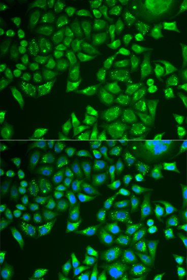 PNLIP Rabbit polyclonal antibody