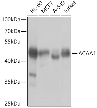 ACAA1 Rabbit polyclonal antibody