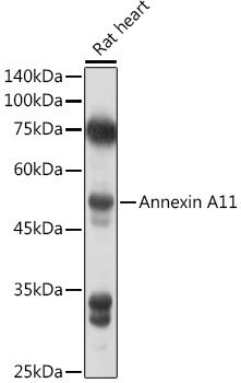 Annexin A11 Rabbit polyclonal antibody