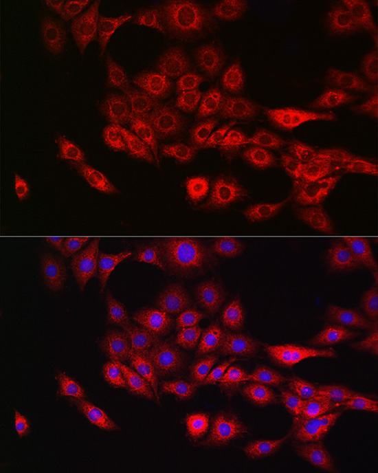 Annexin A11 Rabbit polyclonal antibody