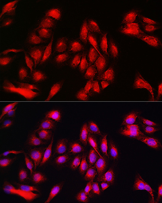 Annexin A11 Rabbit polyclonal antibody