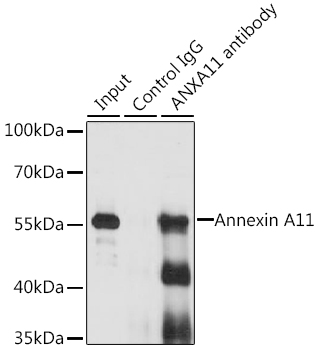 Annexin A11 Rabbit polyclonal antibody