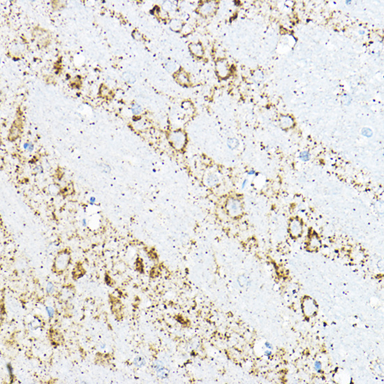 BCAT2 Rabbit polyclonal antibody