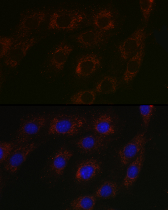BCAT2 Rabbit polyclonal antibody