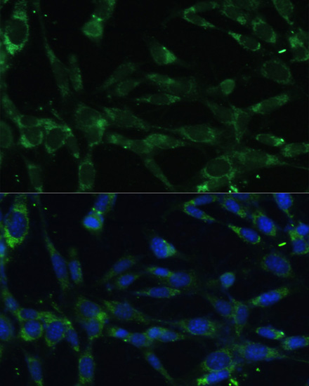 CAPN5 Rabbit polyclonal antibody
