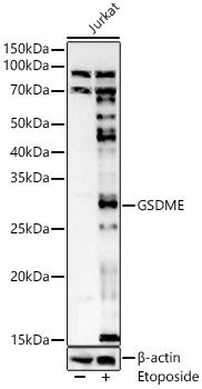 GSDME (Full length+N terminal)Rabbit polyclonal antibody