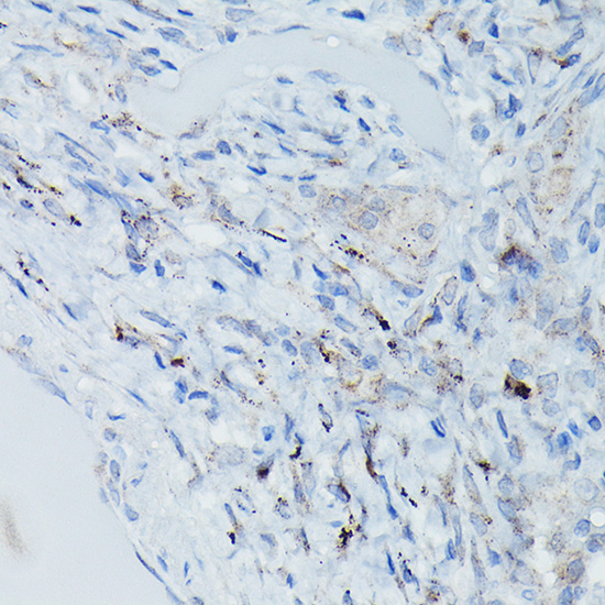 GSDME (Full length+N terminal)Rabbit polyclonal antibody
