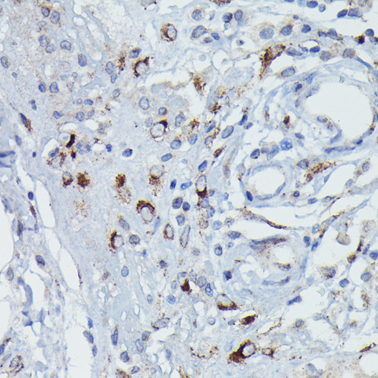 GSDME (Full length+N terminal)Rabbit polyclonal antibody
